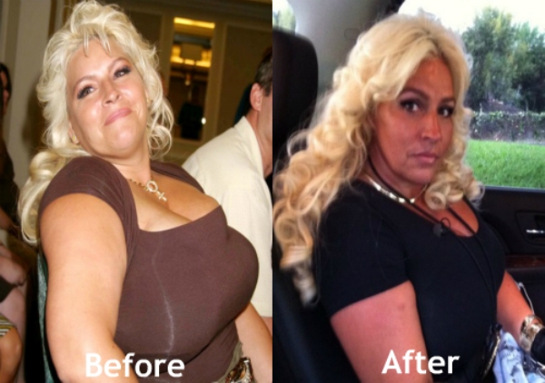 dog the bounty hunter beth weight loss