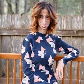 Lizzie Velásquez