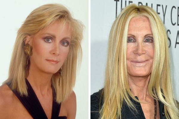 Joan Van Ark.