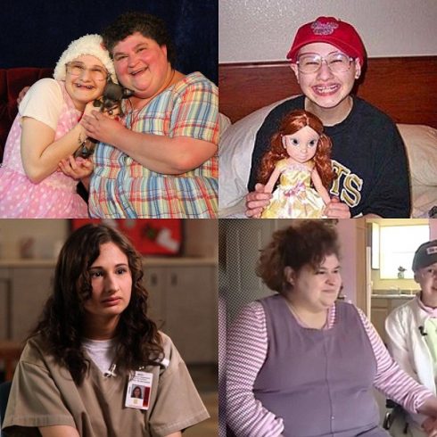 The Severe Form Of Munchausen Syndrome By Proxy! Dee Dee Blanchard’s ...