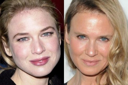 Renee Zellweger finally opens up about plastic surgery allegations ...