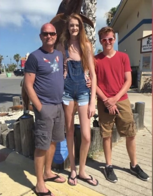 Maci Currin, 17 from Texas has the longest legs (female) in the world ...