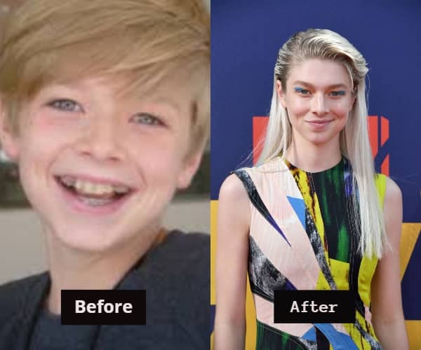 Hunter Schafer before and after surgery. 