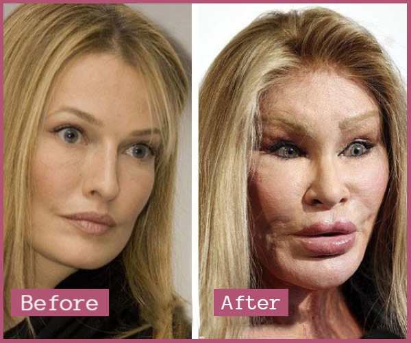 Jocelyn Wildenstein Surgery Photos Net Worth Explored Business Guide Africa 