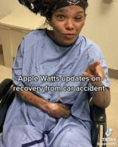 Who is Apple Watts? Recent update on her health after the horrific car accident of March 2022! – Married Biography