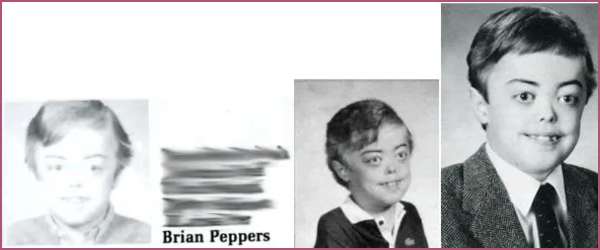 Reason Behind Brian Peppers Death Genetic Disorder Sexual