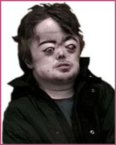 Reason behind Brian Peppers’ death – Genetic disorder, Sexual allegation, Addiction struggles – Married Biography