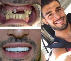 Sam Asghari
