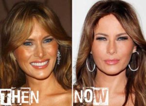 Melania Trump