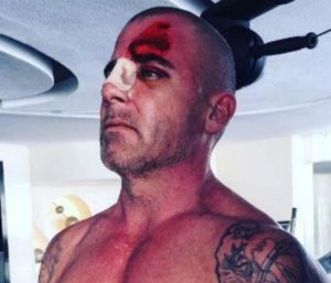 Dominic Purcell